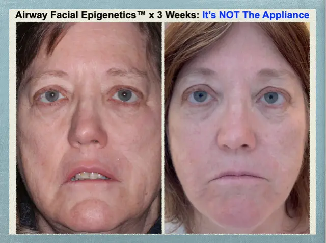 Case 1 - 3 months