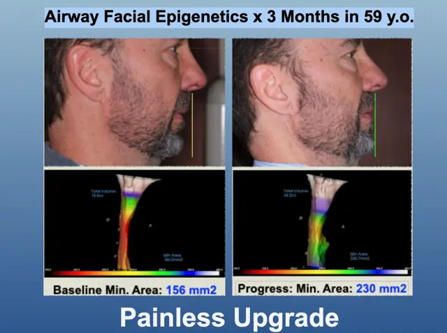 Case 2 - 3 weeks